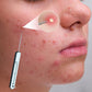 🥳2026 HOT SALE🥳💞50K+ SOLD!🦷 🧳 The Discreet Essential for On-the-Go Freshness. Click, Clean, Retract – Perfect for Travel & Dining. 🚗🔍