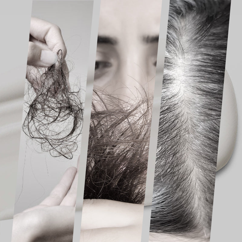 🥳2026 HOT SALE🥳💞50K+ SOLD!🌱🩶 50% OFF! 2-in-1 Silver Hair Dye – Ammonia‑free, enriched with aloe & citrus. Gentle on scalp, natural silver shine. Safe & beautiful! 💆‍♀️✨