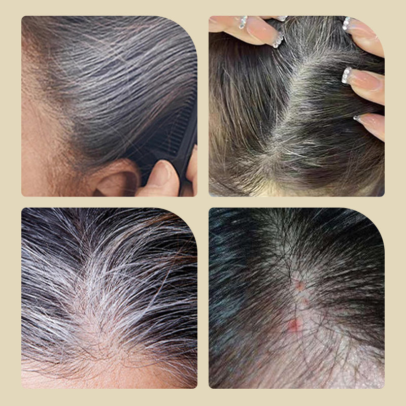 🥳2026 HOT SALE🥳💞50K+ SOLD!✨🪮 50% OFF! Safe & Convenient Comb Hair Dye – Built‑in comb, even coverage. Natural colour, quick grey coverage. Gentle formula, no salon needed. 🌸💇‍♀️