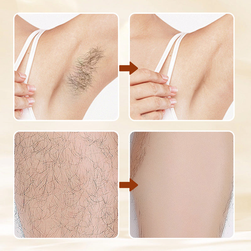🥳2026 HOT SALE🥳💞50K+ SOLD!💥🛁🔥 50% OFF! Aromatic Hair Removal Cream – Gentle on skin, no harsh smell! Works in minutes, leaves skin smooth. Buy more save more – perfect for stock up. Your gentle care essential. 🌸🧴