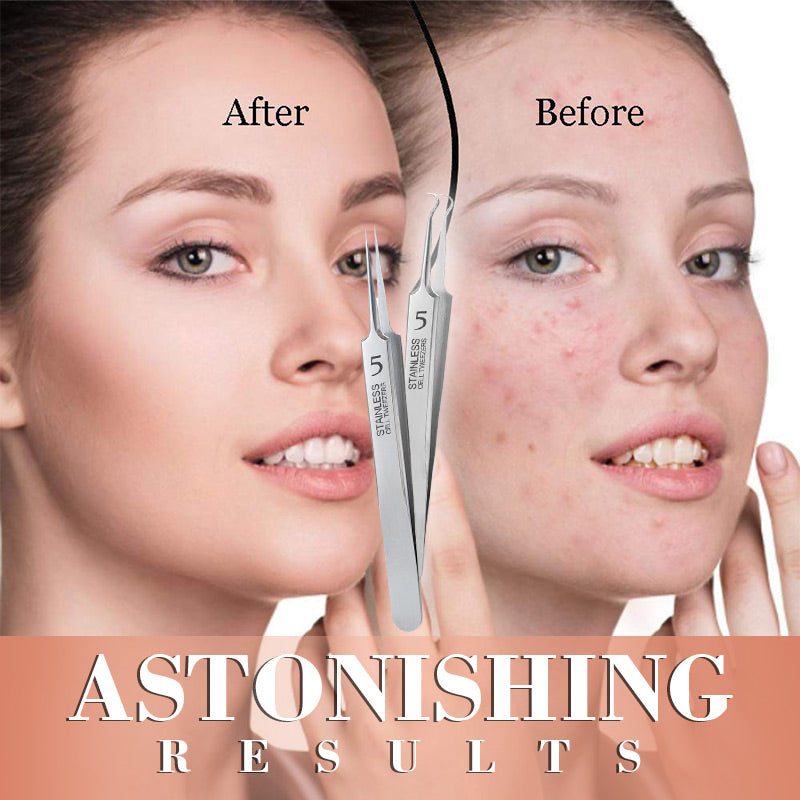 💕Professional Beauty Salon Tweezers | 2026 New Year Launch 50% OFF | Precision Slant & Pointed Tips for Brows & Lashes | Essential for Makeup Artists & Home Kits 🎆✨