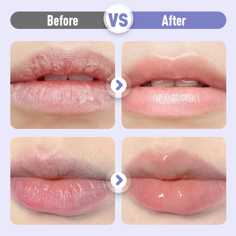 🥳2026 HOT SALE🥳💞50K+ SOLD!💥💰 The DEAL of the Year! Plumping Serum BOGO |  Unlock Plump, Ageless Lips Instantly! | Deep Lines & Dryness? Overnight Revival! 50% OFF✨👄