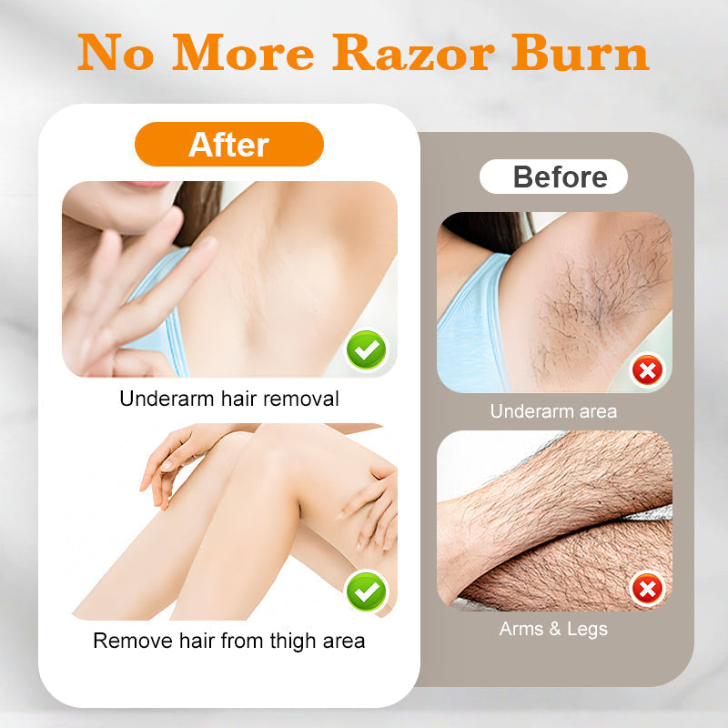 🥳2026 HOT SALE🥳💞50K+ SOLD!🌿 🛁 Gentle Enough for Sensitive Skin. No-Irritation Hair Removal Spray – 50% OFF! ✨🔄