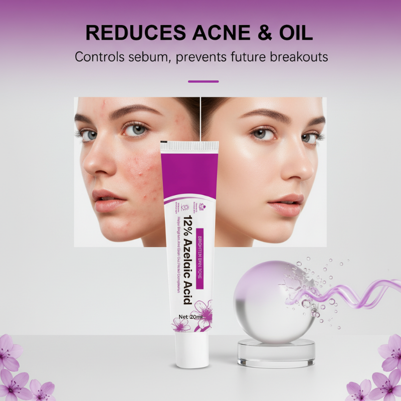 🥳2026 HOT SALE🥳💞50K+ SOLD! 💊✨ 50% OFF! Azelaic Acid Acne Cream – 12% azelaic acid reduces oil & clears breakouts. Fast‑acting formula – visibly smoother skin in days! 🔬💪