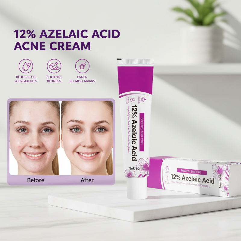🥳2026 HOT SALE🥳💞50K+ SOLD! 💊✨ 50% OFF! Azelaic Acid Acne Cream – 12% azelaic acid reduces oil & clears breakouts. Fast‑acting formula – visibly smoother skin in days! 🔬💪