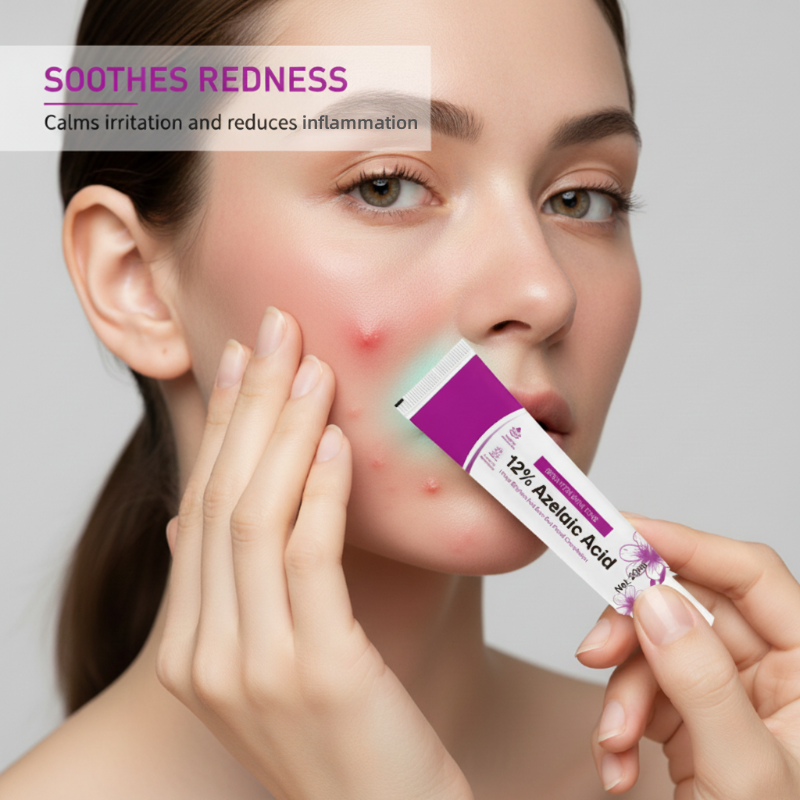 🥳2026 HOT SALE🥳💞50K+ SOLD! 💊✨ 50% OFF! Azelaic Acid Acne Cream – 12% azelaic acid reduces oil & clears breakouts. Fast‑acting formula – visibly smoother skin in days! 🔬💪