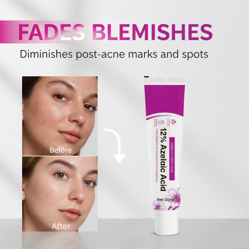 🥳2026 HOT SALE🥳💞50K+ SOLD! 💊✨ 50% OFF! Azelaic Acid Acne Cream – 12% azelaic acid reduces oil & clears breakouts. Fast‑acting formula – visibly smoother skin in days! 🔬💪