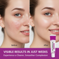🥳2026 HOT SALE🥳💞50K+ SOLD! 💊✨ 50% OFF! Azelaic Acid Acne Cream – 12% azelaic acid reduces oil & clears breakouts. Fast‑acting formula – visibly smoother skin in days! 🔬💪