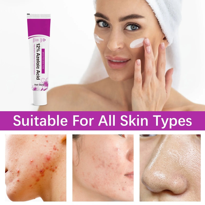 🥳2026 HOT SALE🥳💞50K+ SOLD! 💊✨ 50% OFF! Azelaic Acid Acne Cream – 12% azelaic acid reduces oil & clears breakouts. Fast‑acting formula – visibly smoother skin in days! 🔬💪