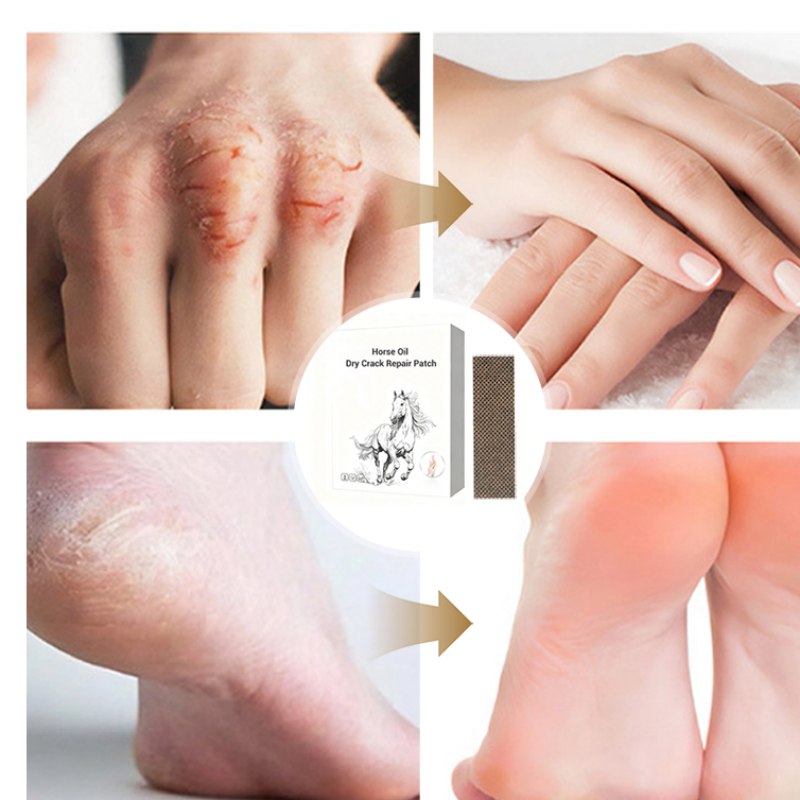 ⏰ Horse Oil Hand & Feet Repair Patch | Christmas SALE 50% OFF | Intensive Hydration for Dry Cracked Skin, Long-Lasting Relief | Perfect Winter Care Gift Set 🎄✨
