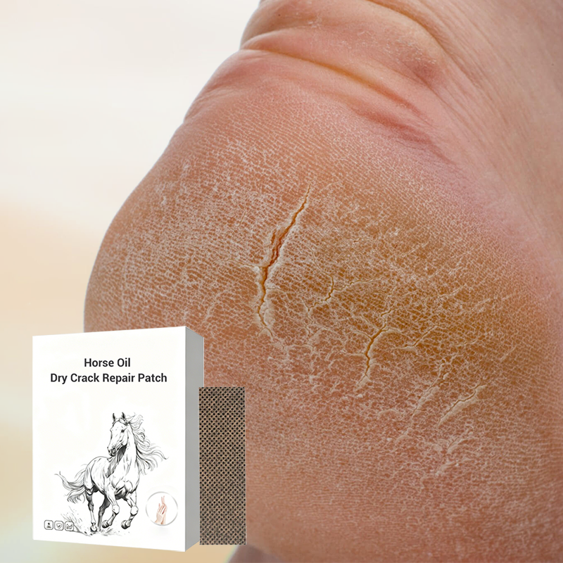 ⏰ Horse Oil Hand & Feet Repair Patch | Christmas SALE 50% OFF | Intensive Hydration for Dry Cracked Skin, Long-Lasting Relief | Perfect Winter Care Gift Set 🎄✨