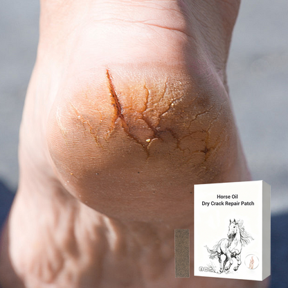 ⏰ Horse Oil Hand & Feet Repair Patch | Christmas SALE 50% OFF | Intensive Hydration for Dry Cracked Skin, Long-Lasting Relief | Perfect Winter Care Gift Set 🎄✨