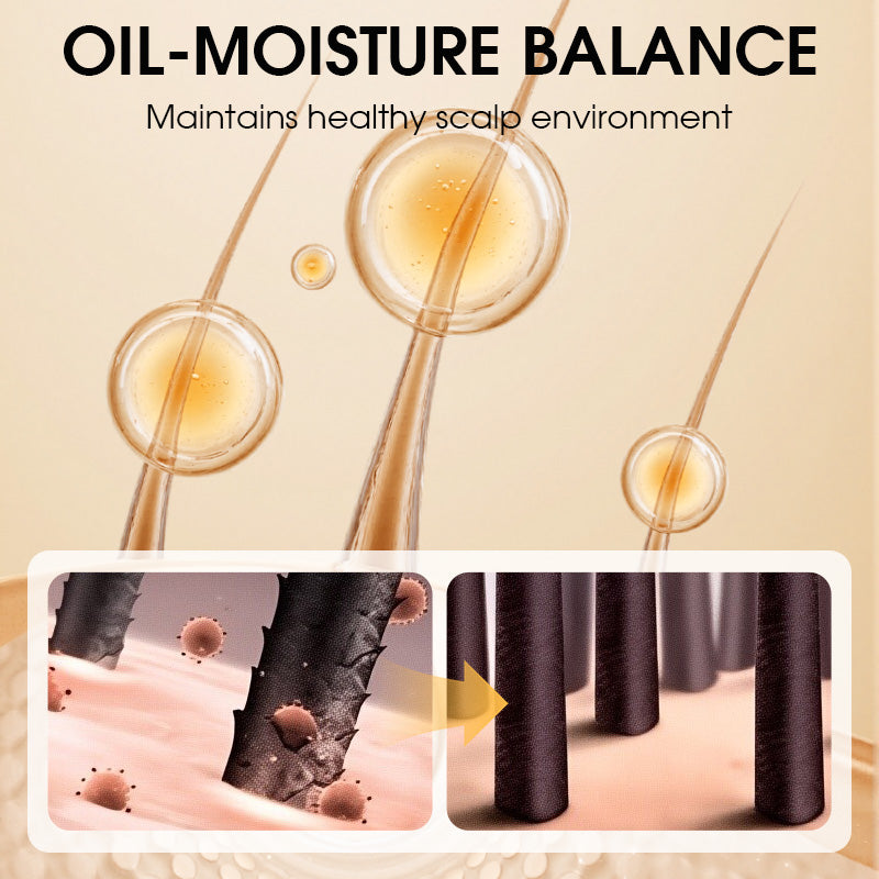 🌱⚖️ Start at the Scalp, End the Worry | Balancing Anti-Dandruff Shampoo for Oily Scalp❄️🔥