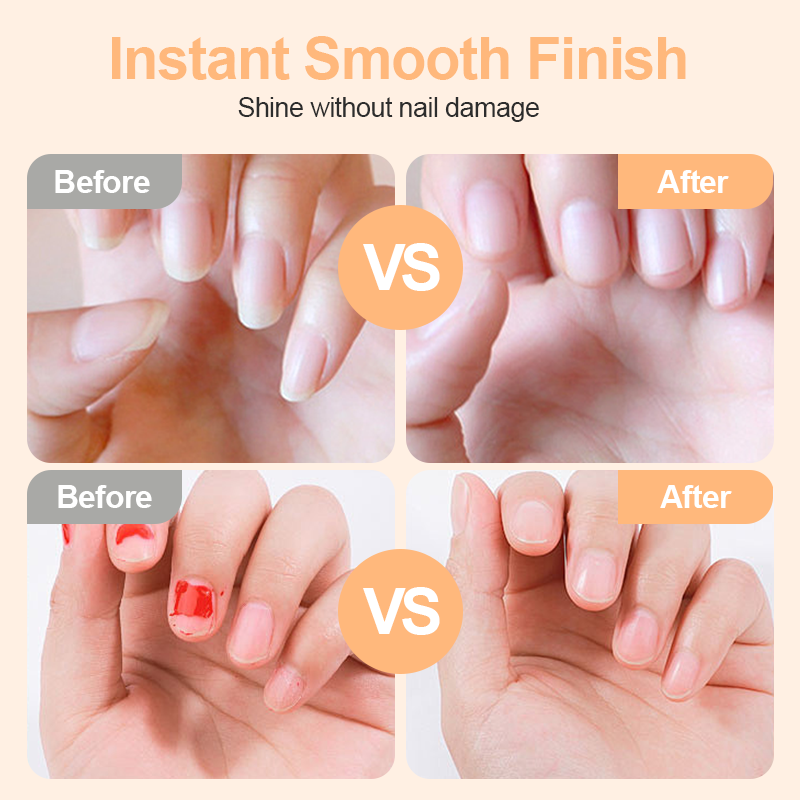 🥳2026 HOT SALE🥳💞50K+ SOLD!⚡💅 50% OFF! 2‑in‑1 Electric Nail Clipper – Cuts & files with anti‑pinch safety. LED light for clear vision. Perfect for seniors & little ones! 🛡️✨