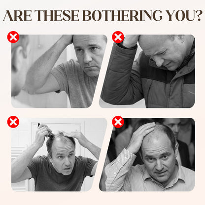 🥳2026 HOT SALE🥳💞50K+ SOLD!🔥 Buy 1 Get 1 FREE! Unisex Hip-Hop Wig Hat – Instant hip-hop style & attitude! Stand out with this bold, comfy 2-in-1 accessory. 🕶️👑