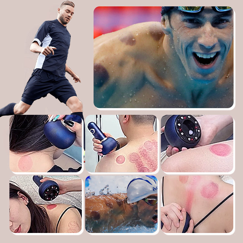 🥳2026 HOT SALE🥳💞50K+ SOLD!💆‍♀️🦵 50% OFF! Electric Cupping & Meridian Massager Set – Release tension & boost energy at home. Modern tech meets ancient wellness for deep muscle relief. ⚡🌀