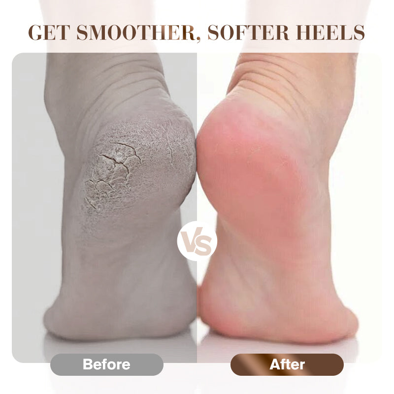 Shock-Absorbing & Breathable Heel Protector