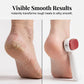 🥳2026 HOT SALE🥳💞50K+ SOLD! 🦶✨ BUY 2 GET 1 FREE! Double Sided Stainless Steel Foot Scraper – Scraper + fine file in one, removes tough calluses & smooths heels. From £6.99 – pro-grade, rust-proof, baby-soft feet at home! 💪🧖‍♀️