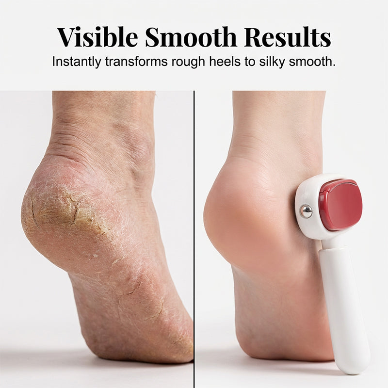 🥳2026 HOT SALE🥳💞50K+ SOLD! 🦶✨ BUY 2 GET 1 FREE! Double Sided Stainless Steel Foot Scraper – Scraper + fine file in one, removes tough calluses & smooths heels. From £6.99 – pro-grade, rust-proof, baby-soft feet at home! 💪🧖‍♀️