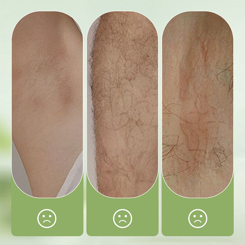 🥳2026 HOT SALE🥳💞50K+ SOLD!🧴🪒50% OFF! Gentle Hair Removal Cream – Removes hair at root, leaves no black spots. 48h light fragrance, painless & easy. Your skin’s new best friend. 👌🕊️