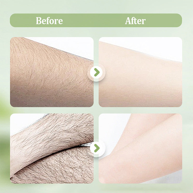 🥳2026 HOT SALE🥳💞50K+ SOLD!🧴🪒50% OFF! Gentle Hair Removal Cream – Removes hair at root, leaves no black spots. 48h light fragrance, painless & easy. Your skin’s new best friend. 👌🕊️