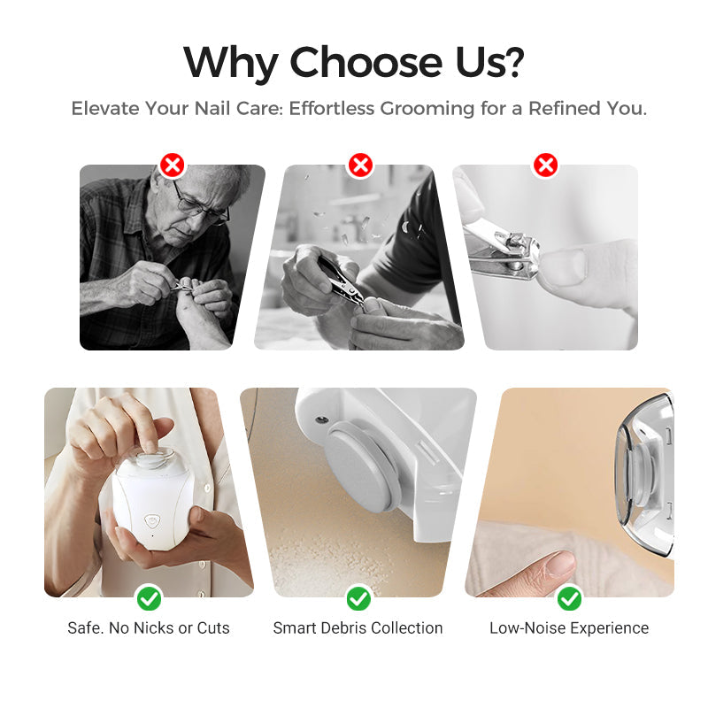 🥳2026 HOT SALE🥳💞50K+ SOLD!🌙🛡️ 50% OFF! 360° Baby Nail Trimmer – Quiet (<25dB), LED light, 3 speeds. Safe for tiny fingers & adults too! 👶💤