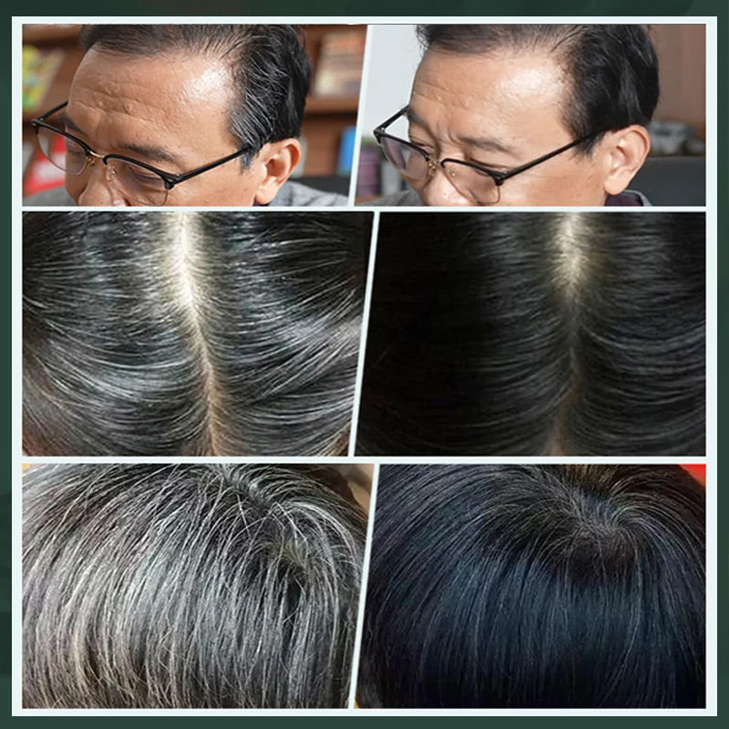 🥳2026 HOT SALE🥳💞50K+ SOLD!🌿🪥 50% OFF! Plant‑Based Comb Hair Dye – Brush & colour in one. No mixing, no mess. Naturally darkens hair. Gentle & chemical‑free! 🌸✨