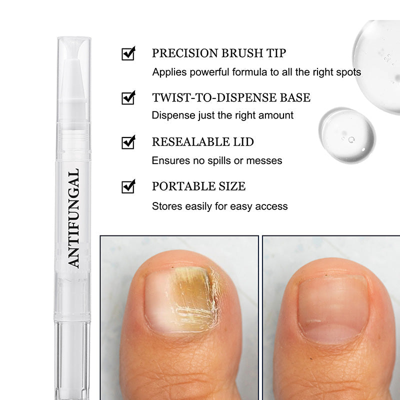🥳2026 HOT SALE🥳💞50K+ SOLD!🔄💚 50% OFF! Toenail Fungus Pen – Targets nail bed, promotes healthy regrowth. No mess, on‑the‑go treatment. A step to beautiful nails. 🌟🦶