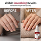 🥳2026 HOT SALE🥳💞50K+ SOLD!⭐🦶 BUY 1 GET 1 FREE! Triple Action Nail Care Kit – Reduces thickness, smooths surface, strengthens brittle nails. Dropper precision. Faster results! 💅✨