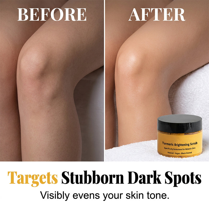 🥳2026 HOT SALE🥳💞50K+ SOLD!🧡✨ 50% OFF! Turmeric Exfoliating Body Scrub – Brightens dark spots, smooths knees & elbows. Natural sea salt + jojoba oil. Reveal younger looking skin! 🌟💛