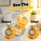 🥳2026 HOT SALE🥳💞50K+ SOLD!👁️🌀 50% OFF! Portable Sonic Contact Lens Cleaner – Deep cleans with ultrasonic vibration. Rechargeable, one‑touch, pocket‑sized. Fresh lenses everyday! ✨🔋