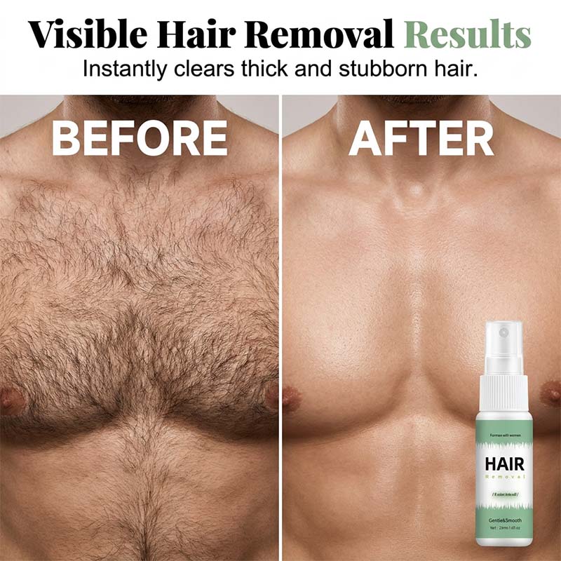 🥳2026 HOT SALE🥳💞50K+ SOLD!🌿💨 50% OFF! Fast‑Acting Hair Removal Spray – Silky smooth in just 8 minutes. Gentle formula with aloe vera – no wax, no razor, no irritation! 🛡️✨