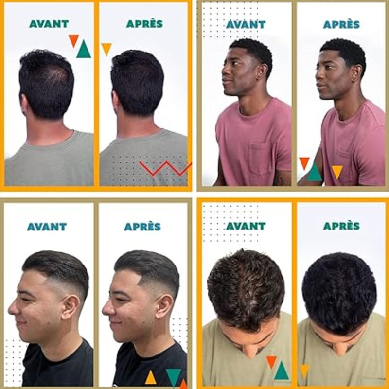 🥳2026 HOT SALE🥳💞50K+ SOLD! 🧔✨ 50% OFF! Hair Building Fibers Set – Instantly covers thinning areas & bald spots. Natural-looking results, easy to apply & wash out with shampoo! 🛁✅