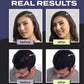 🥳2026 HOT SALE🥳💞50K+ SOLD! 🧔✨ 50% OFF! Hair Building Fibers Set – Instantly covers thinning areas & bald spots. Natural-looking results, easy to apply & wash out with shampoo! 🛁✅