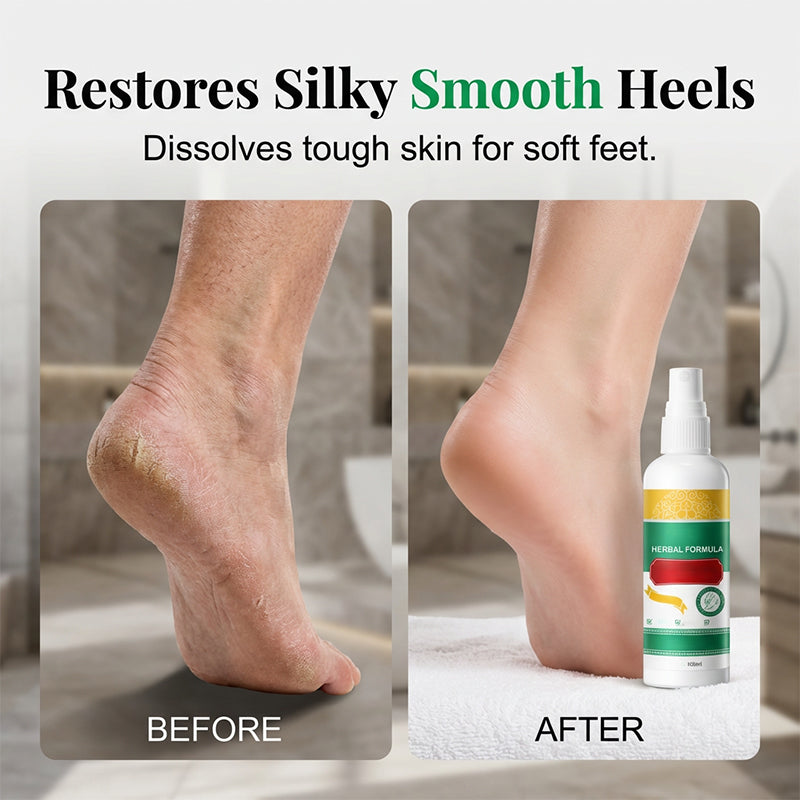 🏆 Last Day Special Price £8.99! 🦶Buy 2 Get 1 Free🎁Refreshing Herbal Foot Care Spray