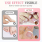 🥳2026 HOT SALE🥳💞50K+ SOLD! 💅✨ Press On Toe Nails – salon-quality pedicure in minutes, no mess. 150 pcs, long-lasting & reusable. Perfect for sandals & special occasions! 🦶💖