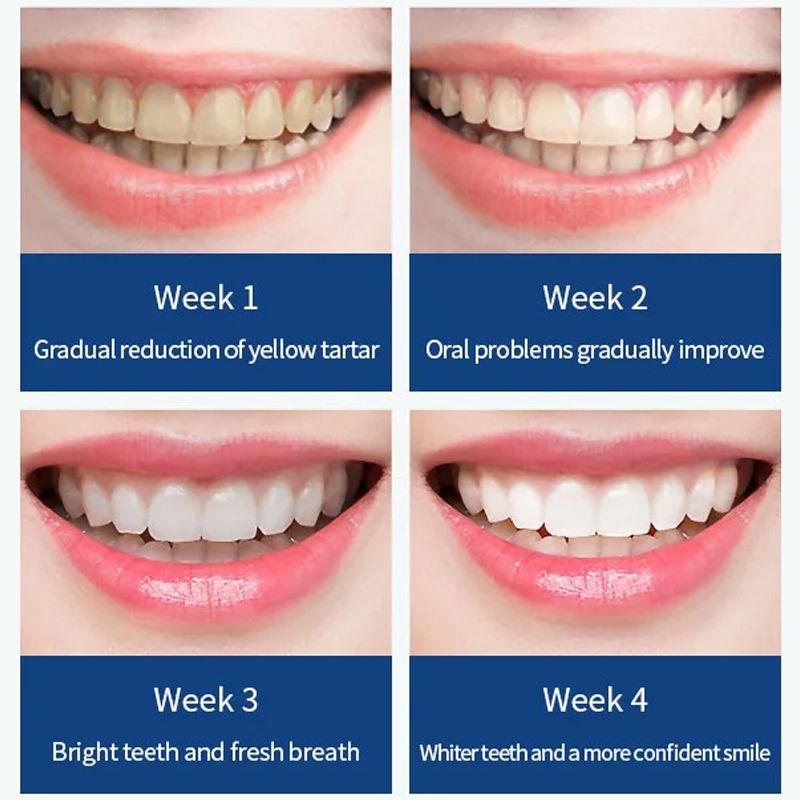 🥳2026 HOT SALE🥳💞50K+ SOLD! 🦷⚡ 50% OFF! Smart Electric Toothbrush – 31,000 RPM deep clean in 60s, smart timer & pressure sensor. Buy 1 get 6 brush heads FREE! IPX7 waterproof, long battery. 🛡️💪