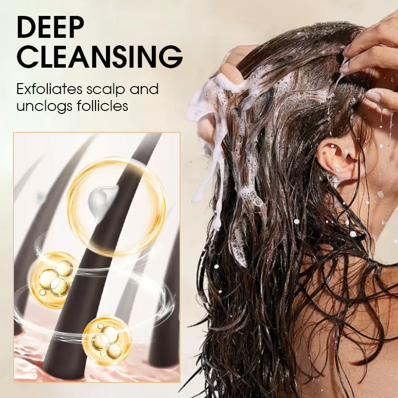 🥳2026 HOT SALE🥳💞50K+ SOLD! 🧴💚 Anti-Dandruff Oil Control Shampoo – 1% Selenium Sulfide + 0.9% Salicylic Acid, reduces flakes in 1 week. Refreshing or volumizing. For oily flaky scalp! 🛡️💪