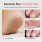 🥳2026 HOT SALE🥳💞50K+ SOLD! 💧🧴 Moisturizing Petroleum Jelly Stick – squalane & hyaluronic acid, hands-free glide-on, heals dry hands & feet. Peach & orange scents! ✨💚